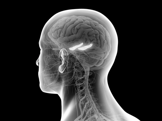 How Brain Surgery Helps Treat Aneurysms
