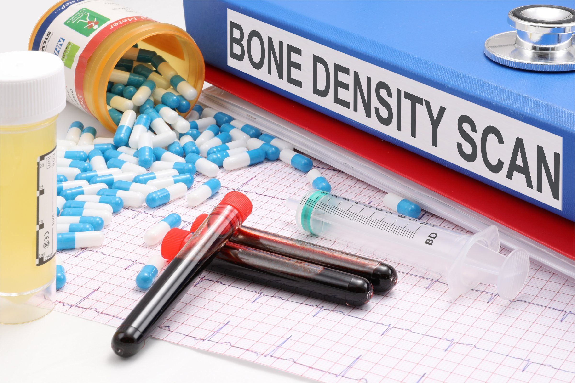 The Importance of Seeing an Endocrinologist for Bone Health